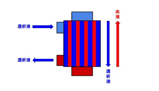 透析中のダイアライザの赤と青の向きはどちらが正解？